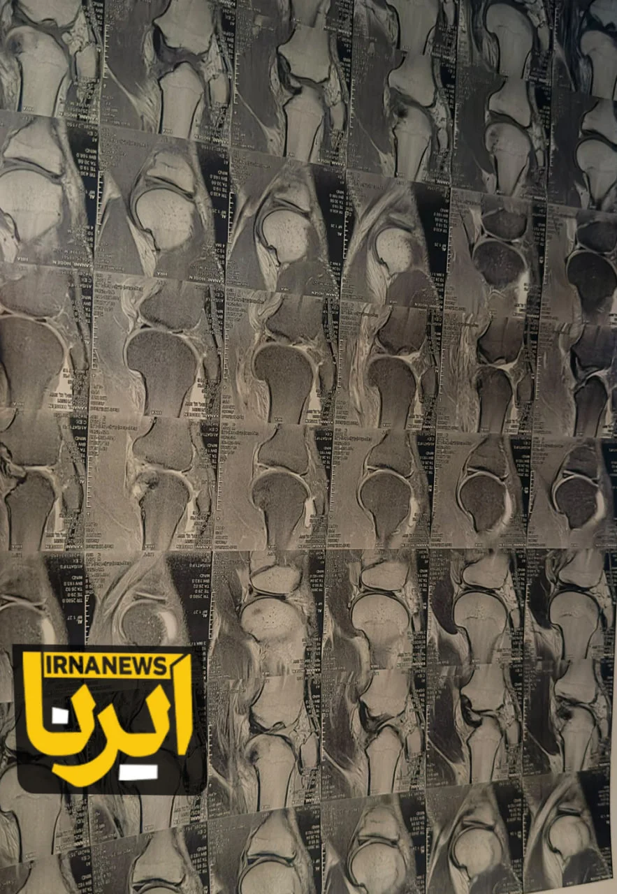 دلیل غیبت کنعانی در لیست تیم ملی، با مدرک مشخص شد