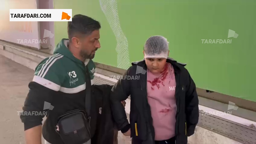 سر هوادار کم سن پرسپولیس به علت سنگ پرانی تماشاگرنماها شکسته شد!