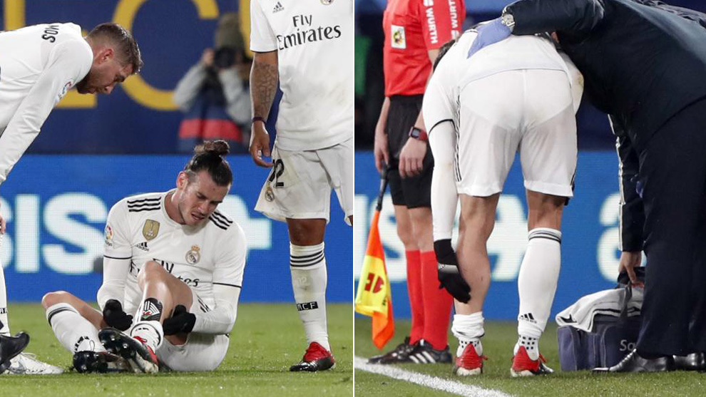 ولز-رئال مادرید-لالیگا-اسپانیا-مصدومیت-real madrid