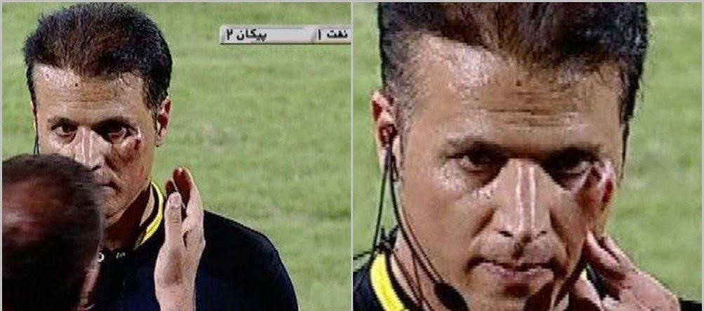 مصدومیت شدید داور دیدار صنعت نفت و پیکان