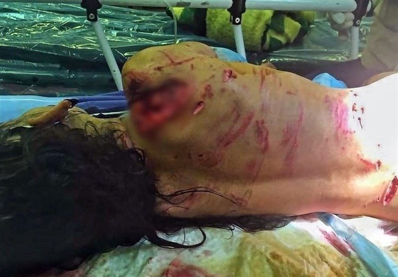دریده شدن یک کودک 7 ساله توسط سگ های ولگرد،ابلهان متوهم فانتزی که مخالف معدوم سازی این حیوانات هستند الان چه چیزی برای گفتن دارن،انسان در محل زندگی خودش باید امنیت داشته باشه
